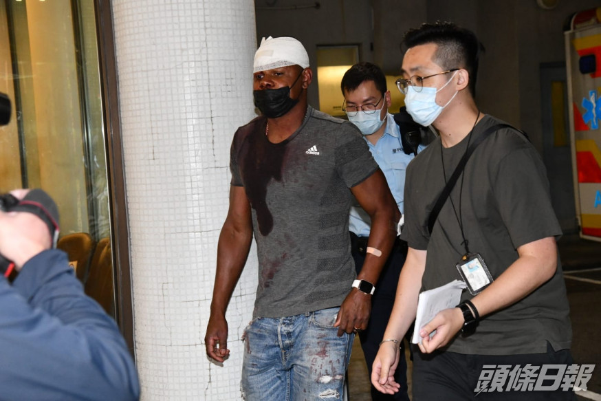涉案外籍男頭部受傷。