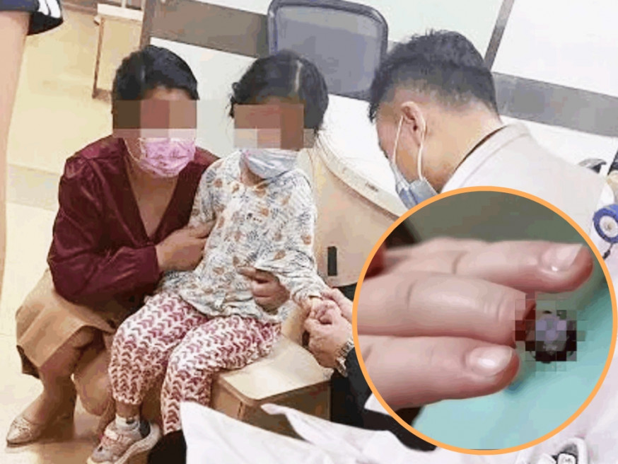 深圳4歲女童貪玩橡筋綁手瞓覺。網圖