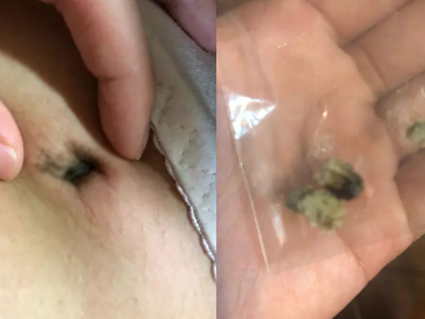 台灣女網友展示自己清出來的陳年肚臍屎。(網上圖片)