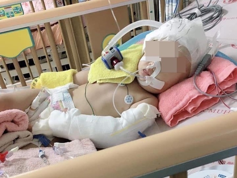 女童媽媽表示,女兒不能咀嚼,迄今要靠鼻胃管餵食,也沒有表達能力,連哭笑都不會。網圖