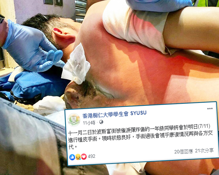 樹仁學生會表示,手術過後會視乎康復情況再與各方交代。 樹仁學生會FB及資料圖片