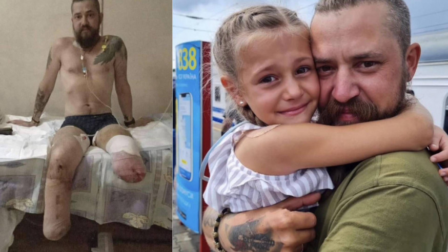 烏克蘭網紅淚訴姊夫雙腳被炸斷，其小外甥女得知爸爸失去雙腳後亦大哭。
