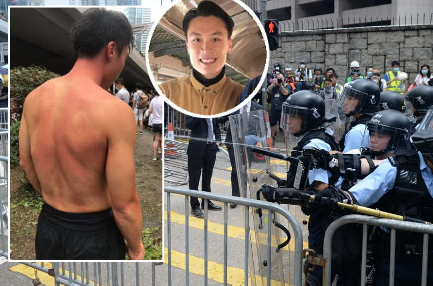澳門記者陳嘉俊指自己毫無保護裝備下,仍遭警員「用胡椒噴霧對着本人頭部噴發」。蘇正謙攝、陳嘉俊fb圖片