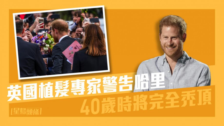 英國植髮專家警告哈里40歲時將完全禿頂。路透社/AP資料圖片