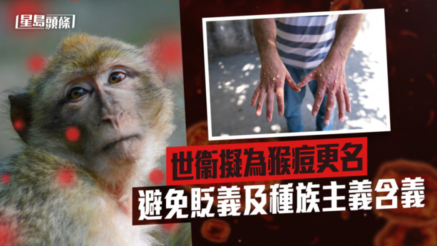 世衞擬為猴痘更名 避免貶義及種族主義含義
