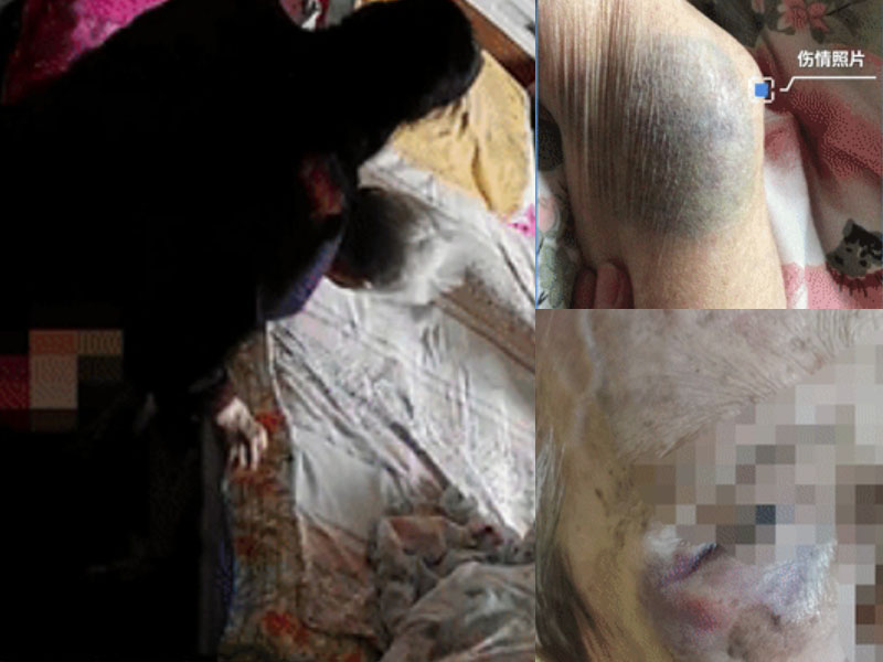 北京朝陽發生一宗保姆虐老事件,保姆涉嫌虐待被看護人罪批准逮捕。(網圖)