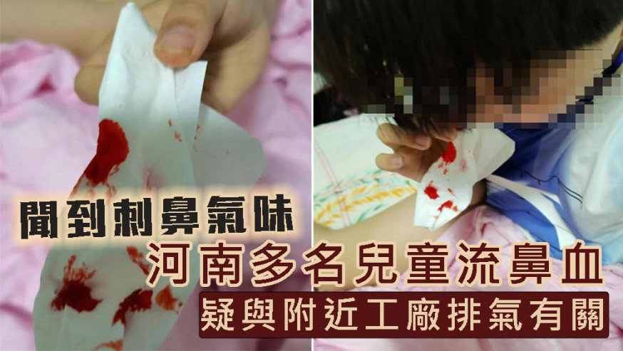 河南多名兒童流鼻血疑與工廠排氣有關,附近4家工廠停工。
