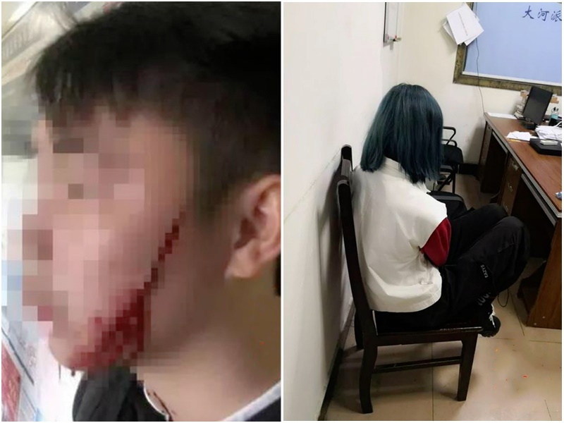 男友臉部被女友割傷。網上圖片