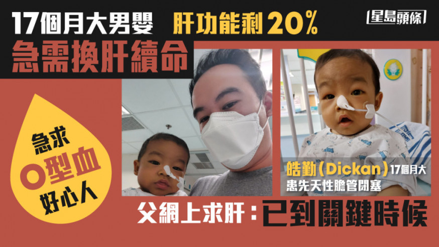 Dickan爸爸指愛兒肝功能只剩下20%。