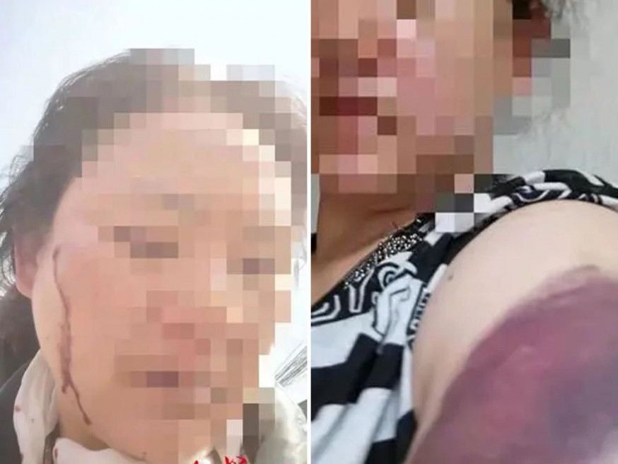 18歲少年沉迷格鬥遊戲患精神病經常毆打父母。