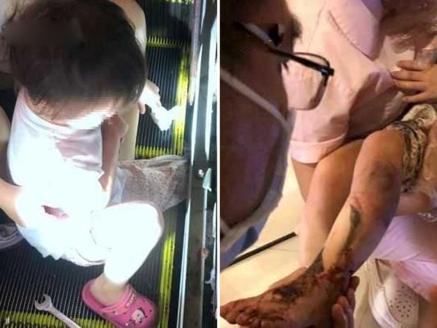 深圳4歲女童小腿被捲入扶手電梯縫隙。