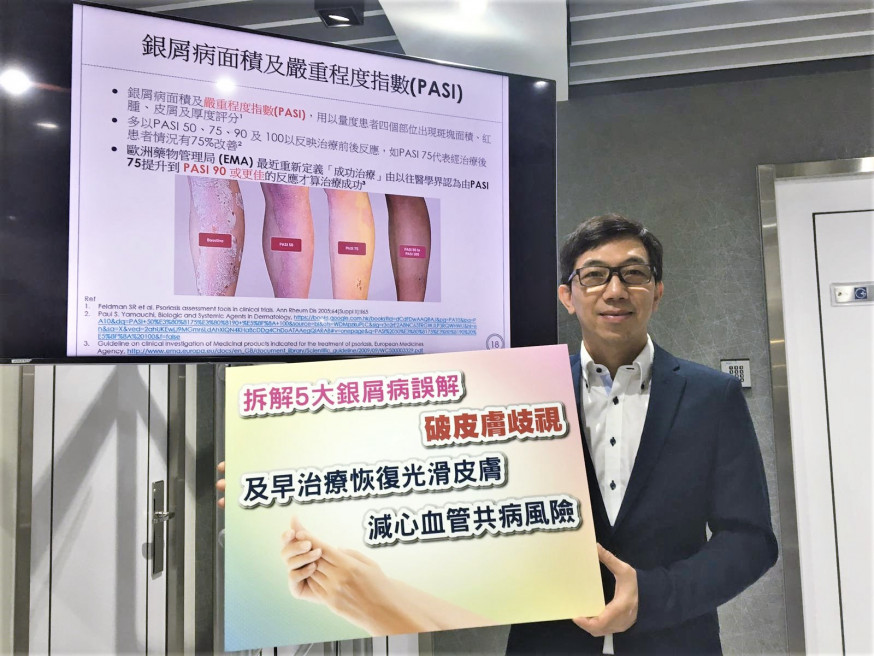 銀屑病誤解多 醫生:生物製劑可有效治療