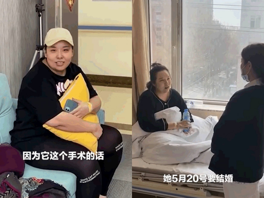 吉林女為以最佳狀態參加閨密婚禮,切胃減肥8日瘦6公斤。網圖