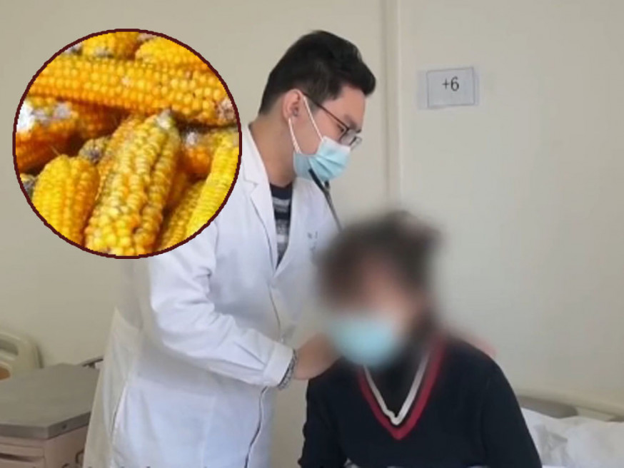 23歲女子因接觸霉變玉米，咳喘一個多月不止，醫生指其肺部長滿真菌。網圖