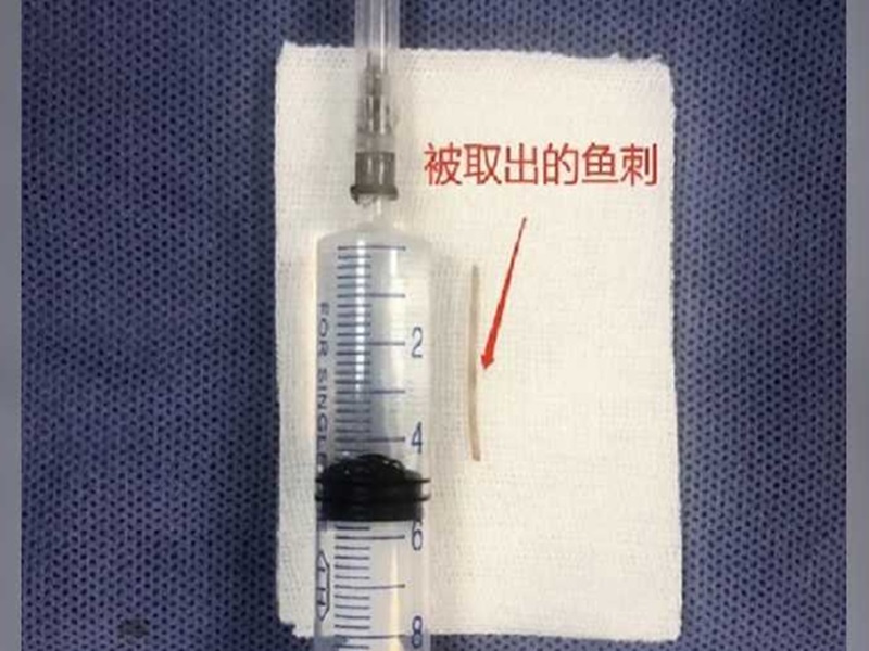 取出的魚骨。網圖