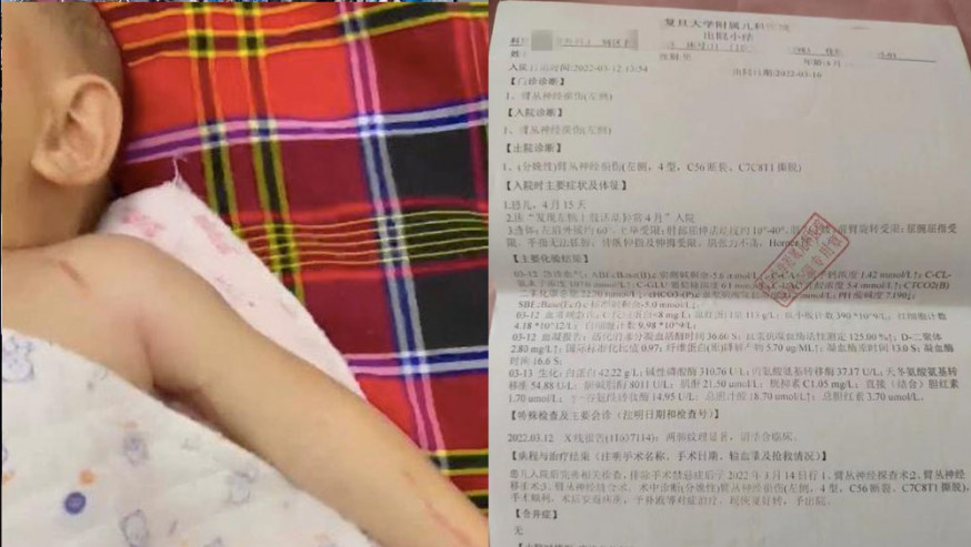 河南新生嬰兒臂叢神經被醫生拉斷，院方30萬私了被拒。