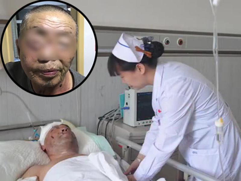 黑龍江護林工被熊襲擊,半邊臉被咬脫,需縫100多針。(網圖)