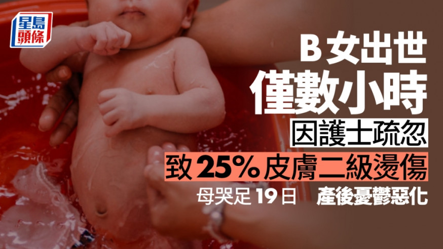 初生B女出世僅數小時 即因護士疏忽致25%皮膚二級燙傷